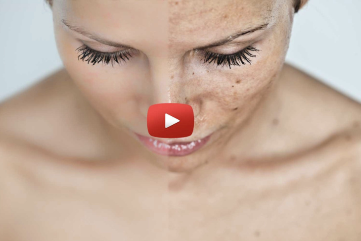 Video-Preview